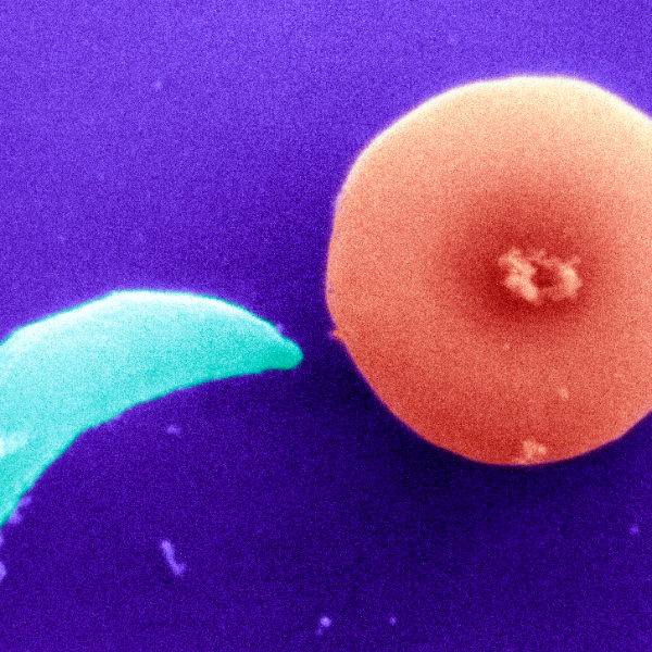 Imagen de El parásito que puede cambiar el comportamiento de una comunidad de lobos: así es el 'toxoplasma gondii'
