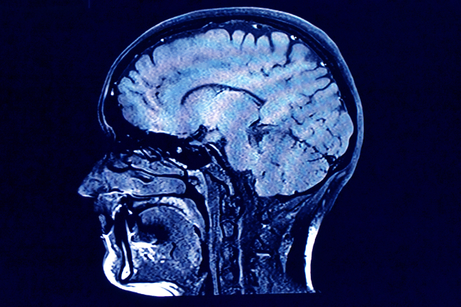 Imagen de Saul Martínez-Horta, neuropsicólogo: 