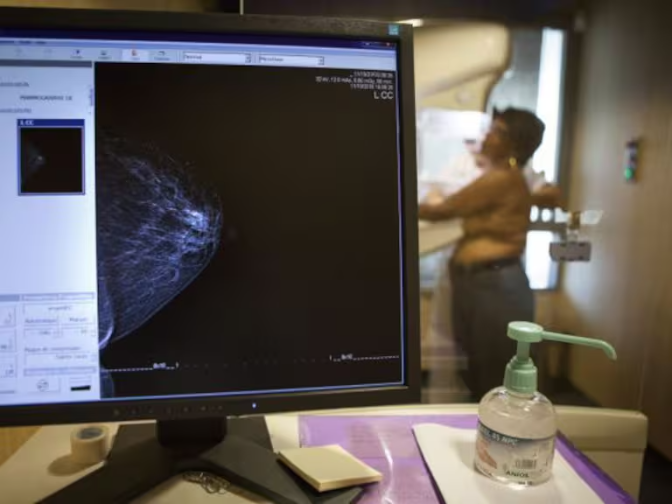 AMAMA analizará los casos de fallecimientos por cáncer de mama tras las denuncias por retrasos en las pruebas diagnósticas: "Tenemos varios casos de mujeres muertas por esto"