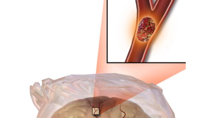 Entrevista Ana Morales Entrevista Ana Morales