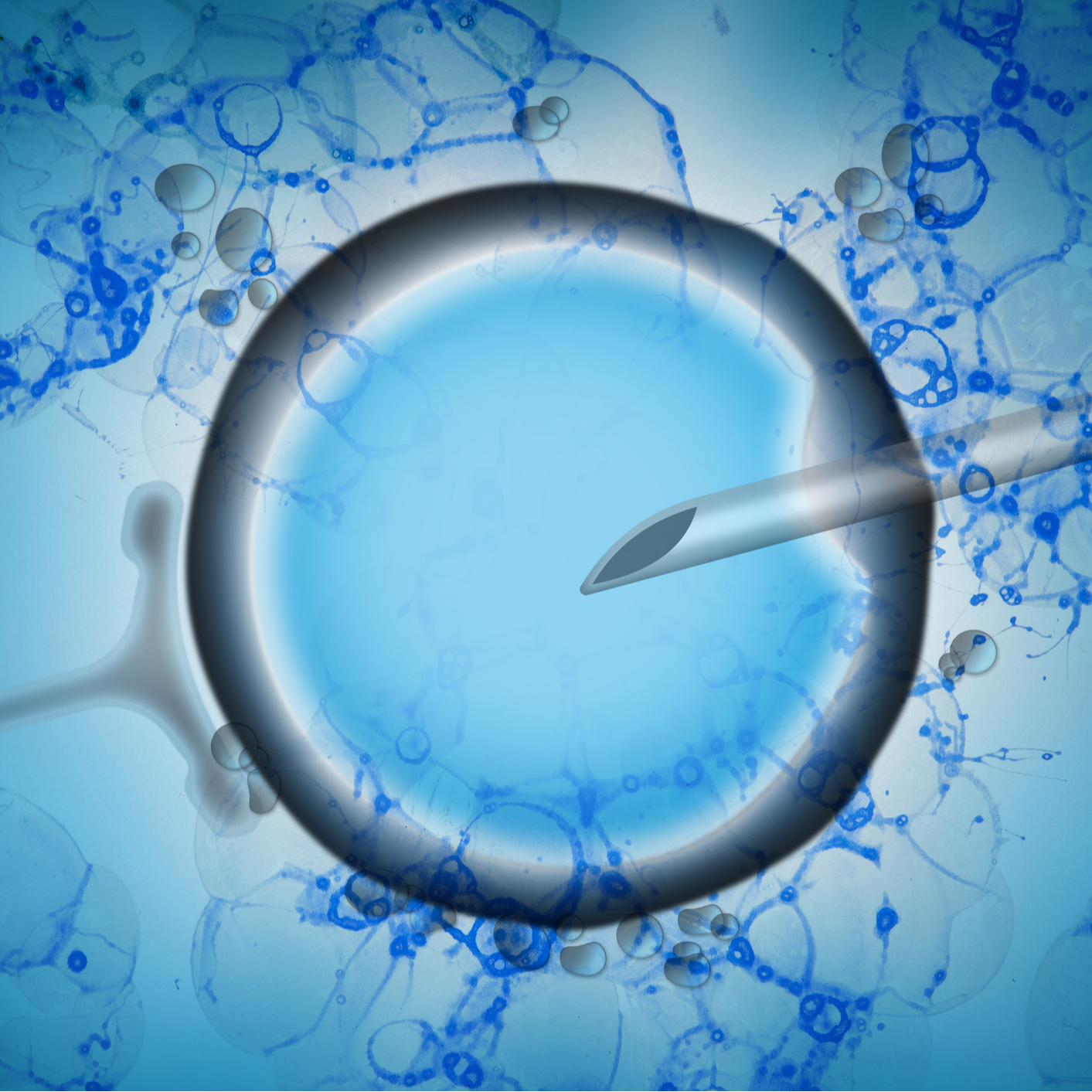 Visión semanal informativa | Los hijos de donantes quieren saber. "No buscamos una familia, buscamos la pieza que nos falta" Visión semanal informativa | Los hijos de donantes quieren saber. "No buscamos una familia, buscamos la pieza que nos falta"