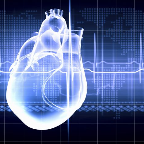 Imagen de El estudio español que va a cambiar el tratamiento del infarto en todo el mundo