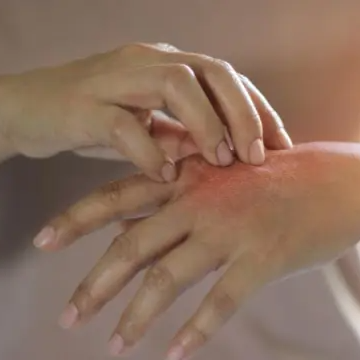 Historias de la pública | La piel, el espejo de nuestra salud