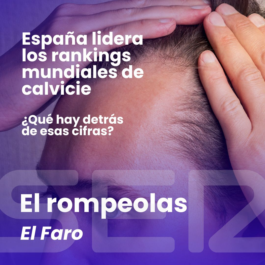 El rompeolas | ¿España es el país con más calvos del mundo?