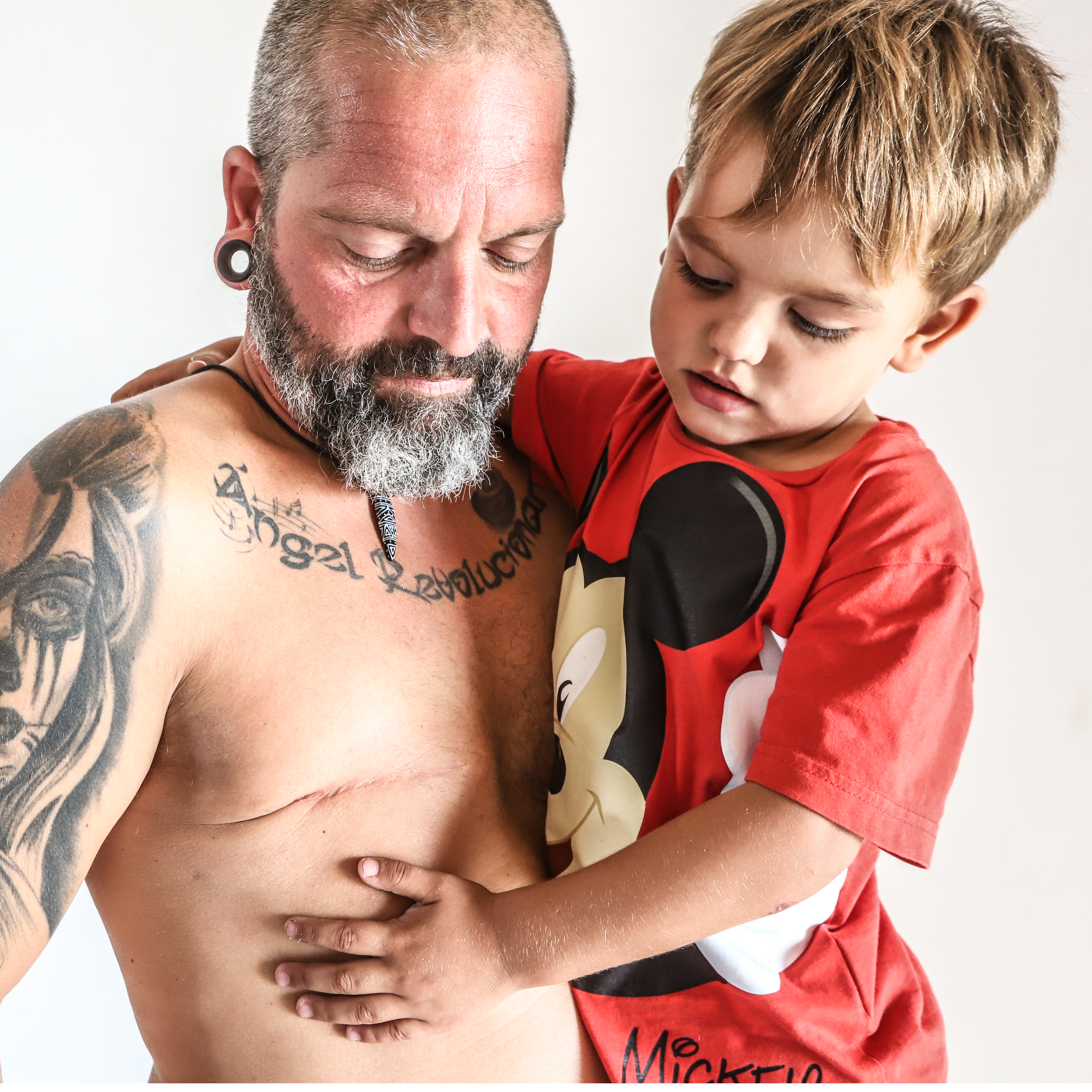 La mirada del paciente | Un padre, una mastectomía y una fotografía para dejar de esconder las cicatrices: así es la historia de Marc, paciente de cáncer de mama