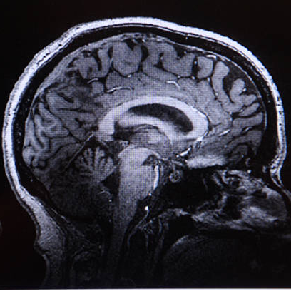 La Ventana a las 16h | Cansancio, torpeza mental, irritabilidad e insomnio: una neurocientífica señala los efectos del calor en el cerebro y explica cómo combatirlos