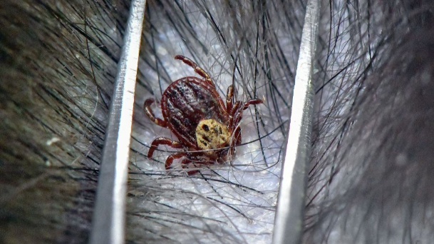 "Me mordió una garrapata y me la quité sin más, ahora tengo muchos dolores y secuelas": así es convivir con la enfermedad de Lyme episode artwork